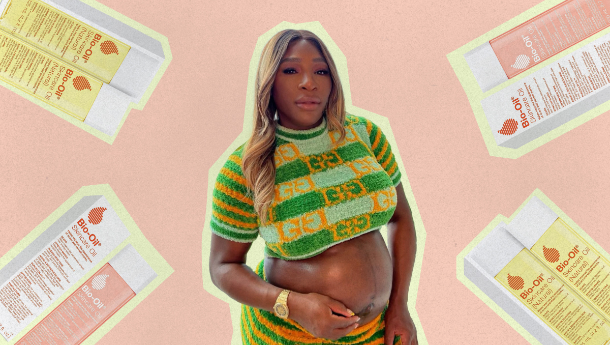 Serena Williams's $25 secret to avoiding stretch marks while